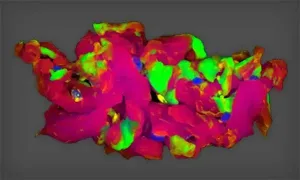 HYPERSPECTRAL